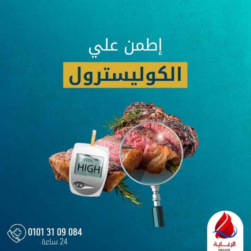 صورة تحليل كوليسترول